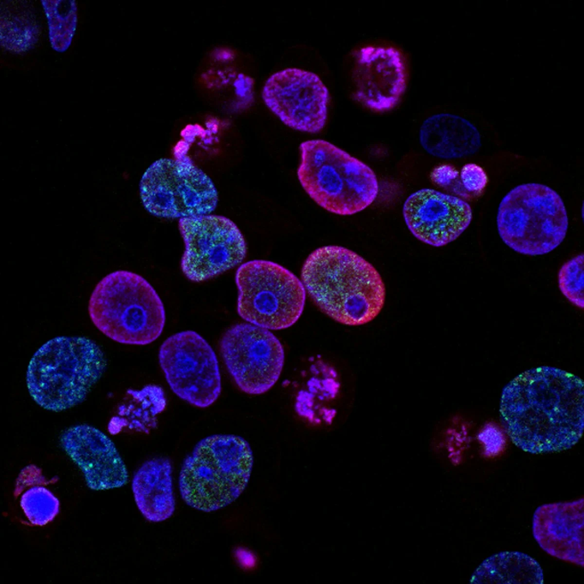 Microscopio en laboratorio clínico